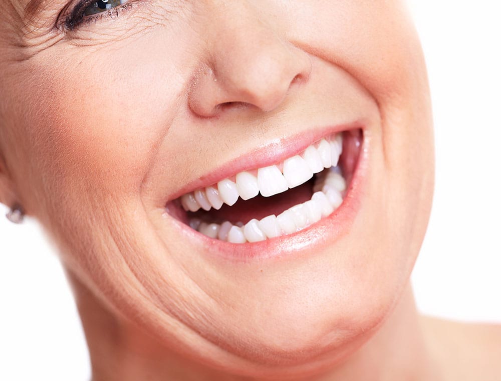 Cosmetic Dental Bridges Elite Simi Valley Dentists
